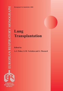 Cover Lung Transplantation (eBook, PDF)