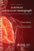 Tuberculosis (eBook, PDF)