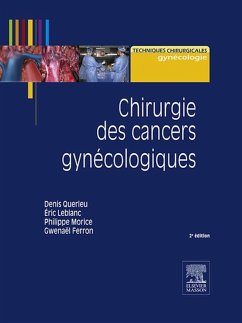 Cover Chirurgie des cancers gynécologiques (eBook, ePUB)