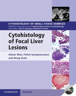 Cytohistology of Focal Liver Lesions (eBook, PDF) - Wee, Aileen
