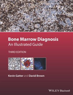 Bone Marrow Diagnosis (eBook, ePUB) - Gatter, Kevin; Brown, David