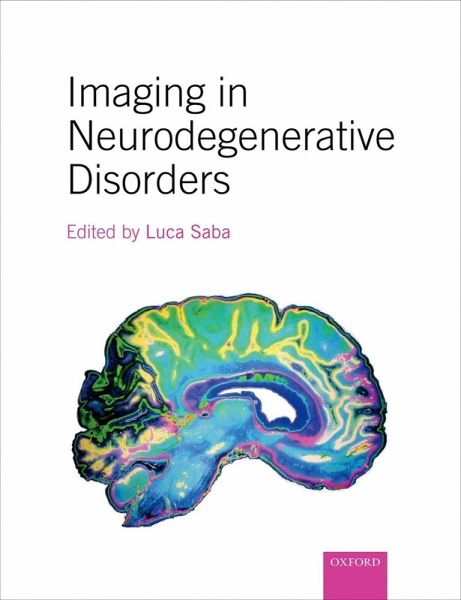 Imaging in Neurodegenerative Disorders (eBook, ePUB)