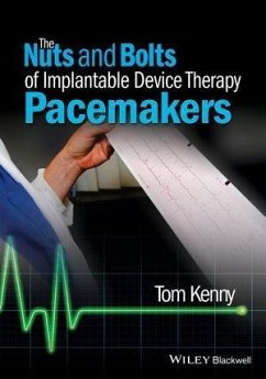 The Nuts and Bolts of Implantable Device Therapy (eBook, ePUB) - Kenny, Tom