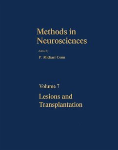 Cover Lesions and Transplantation (eBook, PDF)