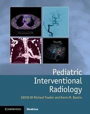 Cover Pediatric Interventional Radiology