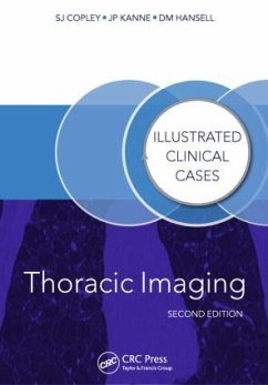 Thoracic Imaging - Copley, Sue; Hansell, David; Kanne, Jeffrey