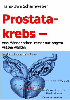 Prostatakrebs (eBook, ePUB) - Scharnweber, Hans-Uwe