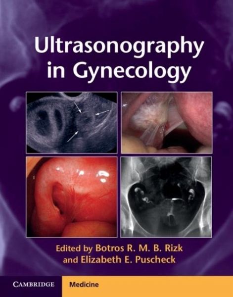 Ultrasonography in Gynecology (eBook, PDF) Ultrasonography in Gynecology (eBook, PDF)