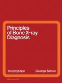 Principles of Bone X-Ray Diagnosis (eBook, PDF)