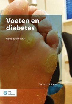 Voeten En Diabetes - van Putten, M.