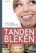 Tanden Bleken - Bild 1