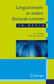 Longcarcinoom En Andere Thoracale Tumoren in Beeld