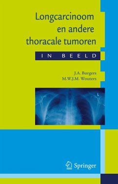 Longcarcinoom En Andere Thoracale Tumoren in Beeld - Burgers, J. A.;Wouters, M.