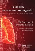 Spectrum of Bronchial Infection (eBook, PDF) Spectrum of Bronchial Infection (eBook, PDF)