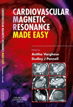 Cardiovascular Magnetic Resonance Made Easy (eBook, ePUB) - Varghese, Anitha; Pennell, Dudley J.