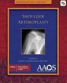 AAOS Shoulder Arthroplasty (eBook, PDF)