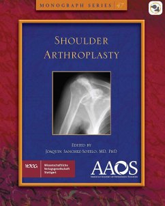 AAOS Shoulder Arthroplasty (eBook, PDF) - Sanchez-Sotelo, Joaquin