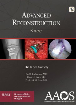 AAOS Advanced Reconstruction Knee (eBook, PDF) - Lieberman, Jay R.; Berry, Daniel J.; Azar, Frederick M.