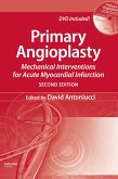 Primary Angioplasty (eBook, PDF)