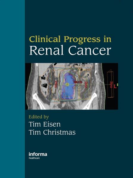 Clinical Progress in Renal Cancer (eBook, PDF) Clinical Progress in Renal Cancer (eBook, PDF)