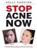 Stop Acne Now: This Is Me and This Is My Secret On How to Treat Acne (eBook, ePUB)
