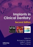 Implants in Clinical Dentistry (eBook, PDF)