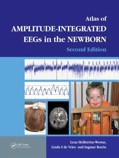 An Atlas of Amplitude-Integrated EEGs in the Newborn (eBook, PDF)