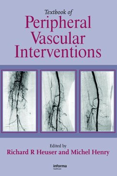 Textbook of Peripheral Vascular Interventions (eBook, PDF)