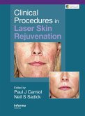 Clinical Procedures in Laser Skin Rejuvenation (eBook, PDF)