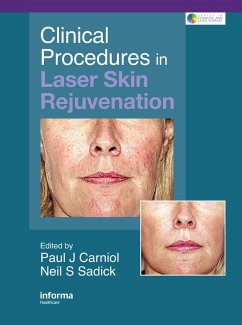 Cover Clinical Procedures in Laser Skin Rejuvenation (eBook, PDF)
