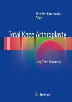 Total Knee Arthroplasty