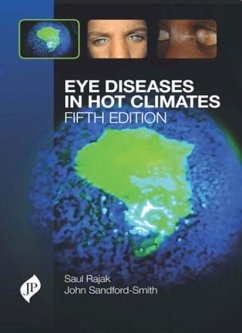 Eye Diseases in Hot Climates - Rajak, Saul N; Sandford-Smith, John