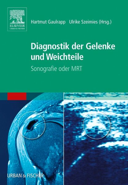 Diagnostik der Gelenke und Weichteile (eBook, ePUB) Diagnostik der Gelenke und Weichteile (eBook, ePUB)