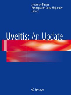 Uveitis: An Update