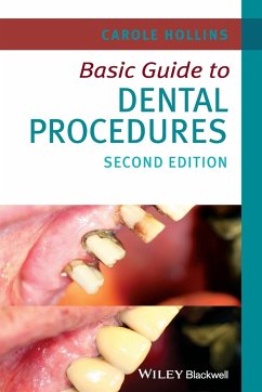 Basic Guide to Dental Procedures - Hollins, Carole