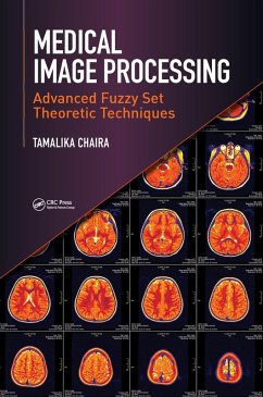 Medical Image Processing (eBook, PDF) - Chaira, Tamalika