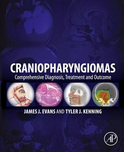Craniopharyngiomas (eBook, ePUB)