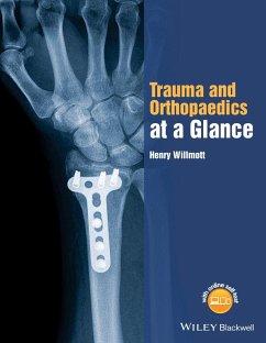 Trauma and Orthopaedics at a Glance - Willmott, Henry