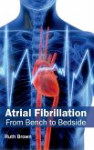 Atrial Fibrillation