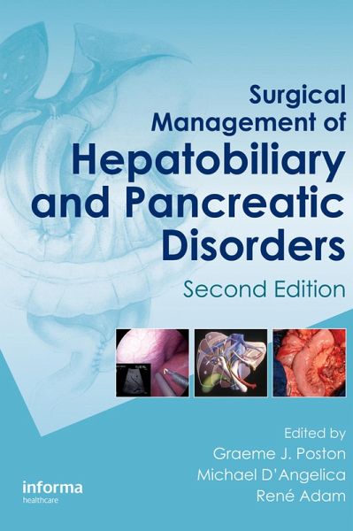 Surgical Management of Hepatobiliary and Pancreatic Disorders, Second Edition (eBook, PDF) Surgical Management of Hepatobiliary and Pancreatic Disorders, Second Edition (eBook, PDF)