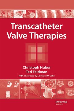 Transcatheter Valve Therapies (eBook, PDF) - Huber, Christoph; Feldman, Ted