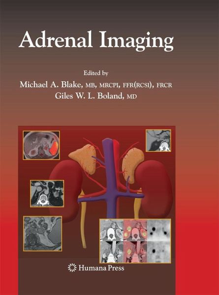 Adrenal Imaging Adrenal Imaging