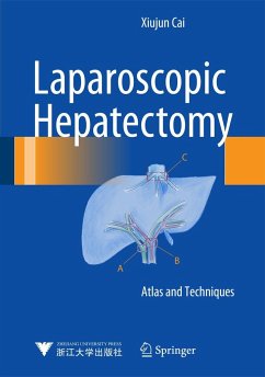 Laparoscopic Hepatectomy - Cai, Xiujun