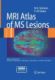 MRI Atlas of MS Lesions