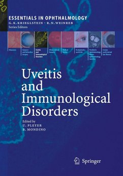 Uveitis and Immunological Disorders