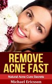 Remove Acne Fast: Natural Acne Cure Secrets (eBook, ePUB)