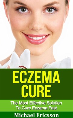 Eczema Cure: The Most Effective Solution to Cure Eczema Fast (eBook, ePUB) - Ericsson, Michael Eczema Cure: The Most Effective Solution to Cure Eczema Fast (eBook, ePUB) - Ericsson, Michael