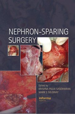Cover Nephron-Sparing Surgery (eBook, PDF)