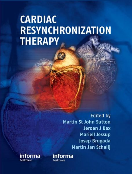 Cardiac Resynchronization Therapy (eBook, PDF) Cardiac Resynchronization Therapy (eBook, PDF)