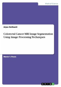 Colorectal Cancer MRI Image Segmentation Using Image Processing Techniques